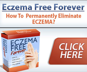 Eczema Free
